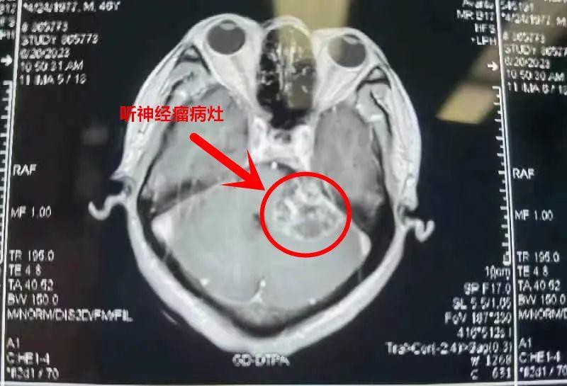 陪人就诊被看出脑瘤怎么处理_资料解释