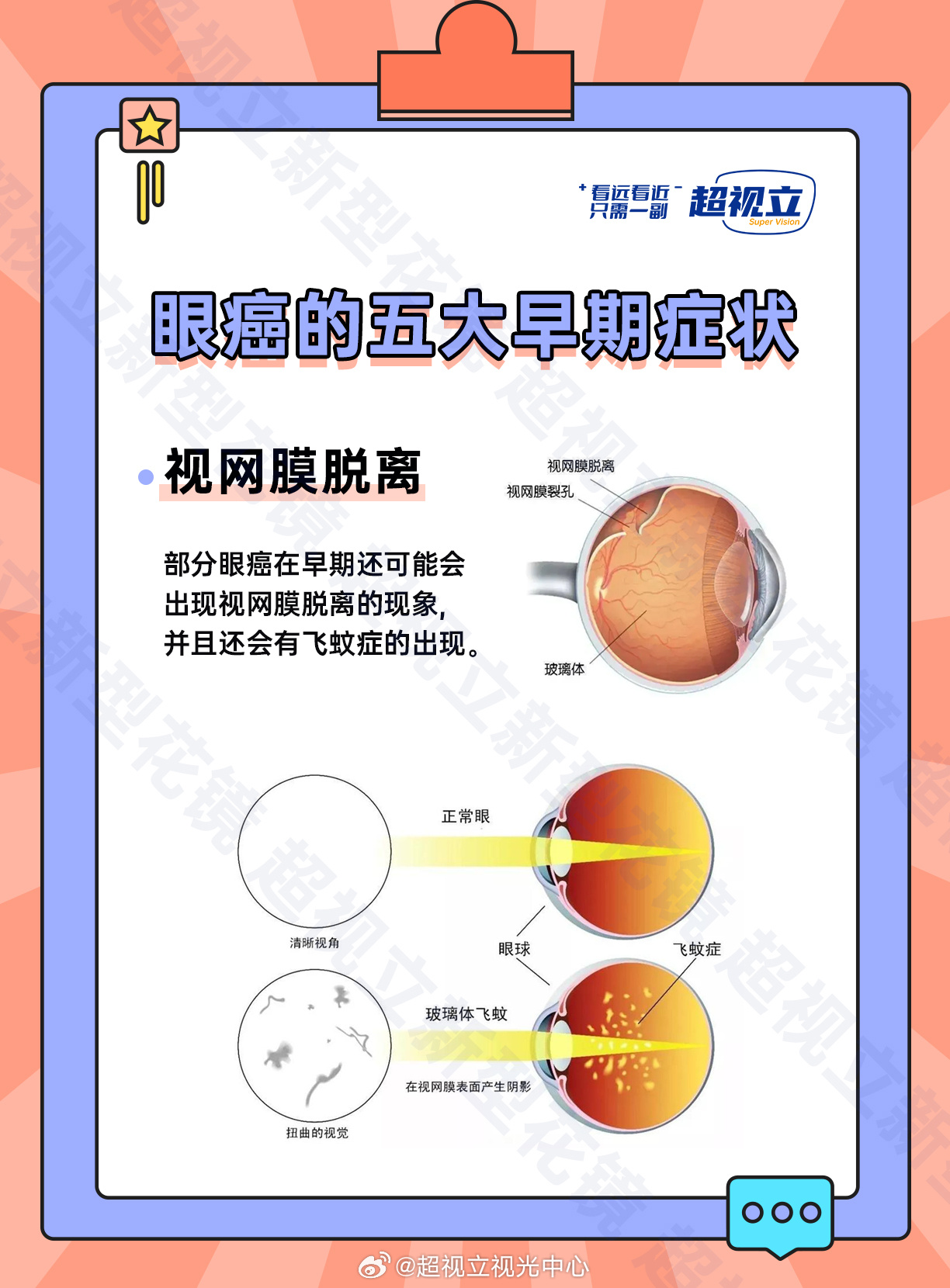 眼睛不适患不死癌症，深度解析与应对之道