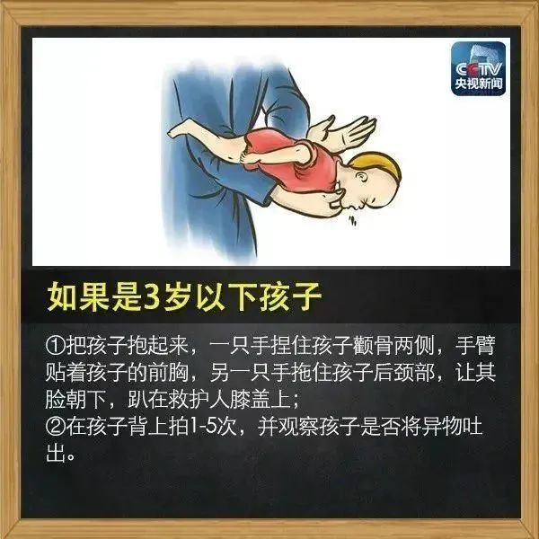 幼儿遭食物卡喉，深圳医生5秒速救——生命的奇迹时刻