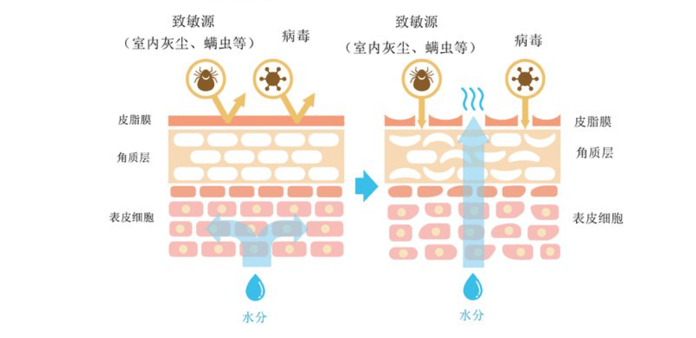 网上爆火的“以油养肤”有用吗