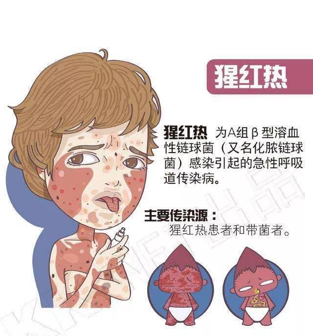 广东省突发！猩红热病例激增，2328例确诊背后的真相令人揪心！