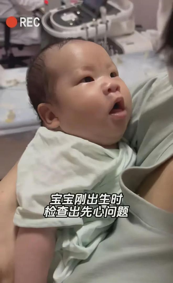 王暖暖孩子患先心病